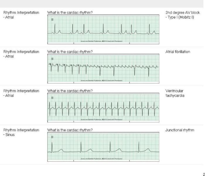 Relias basic dysrhythmia test a answers