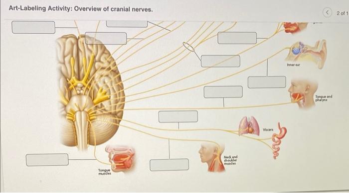 Art-labeling activity: overview of cranial nerves.