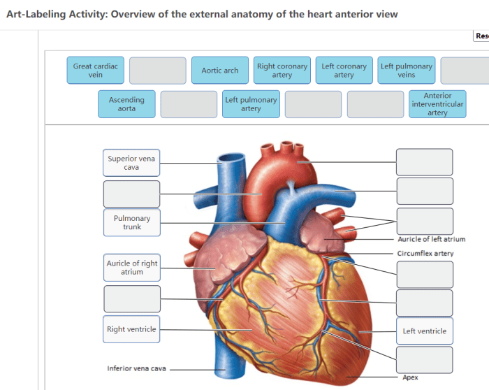 Art-labeling activity: overview of cranial nerves.