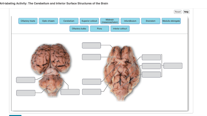 Art-labeling activity: overview of cranial nerves.